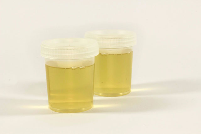 Urine homemade Pregnancy Test