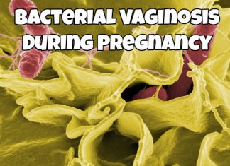 Bacterial Vaginosis During Pregnancy