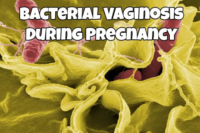 Bacterial Vaginosis During Pregnancy