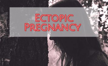 Ectopic Pregnancy