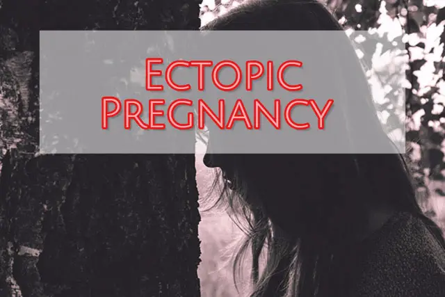 Ectopic Pregnancy 