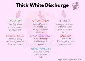 Thick White Vaginal Discharge Types What They Mean Infographic The