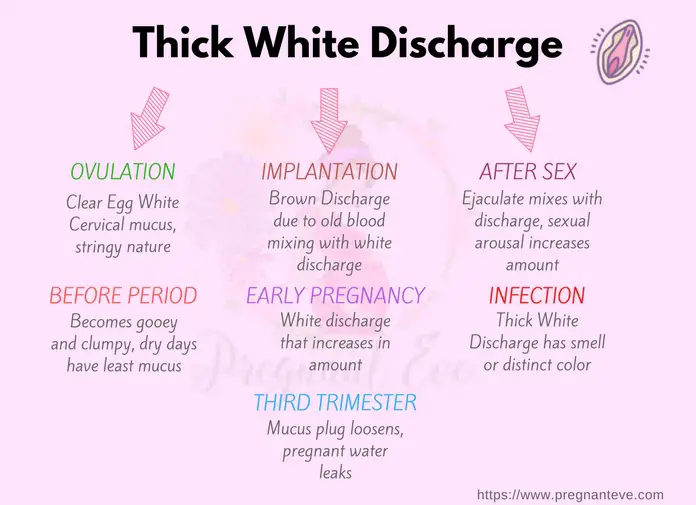 Thick White Discharge Types Causes Treatment