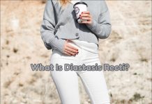 Diastasis Recti