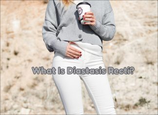 Diastasis Recti