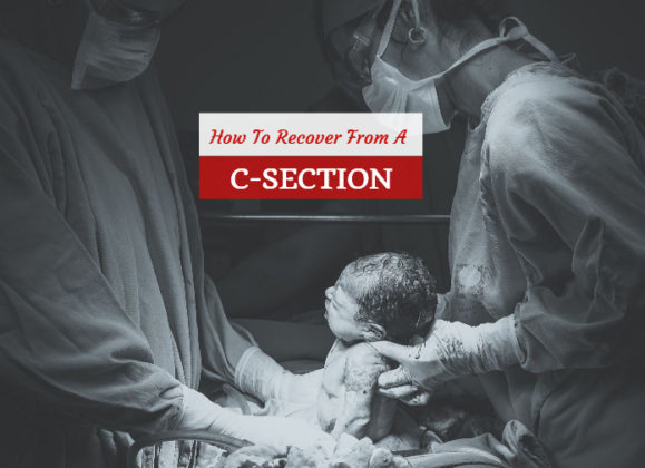 C-Section Recovery: Caesarean Aftercare