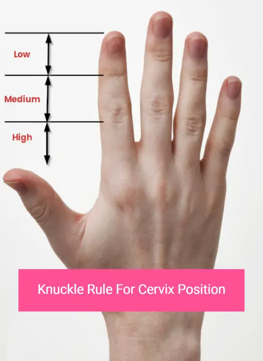 Knuckle rule for cervix position