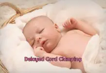 Delayed Cord Clamping And Risks