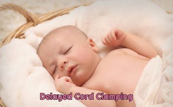 Delayed Cord Clamping And Risks