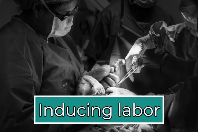 Inducing labor: When and How Labor Is Induced